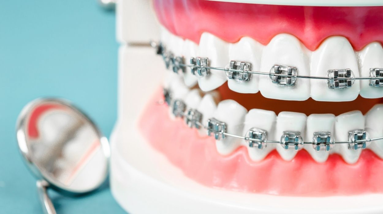 Jakie wyróżniamy aparaty ortodontyczne