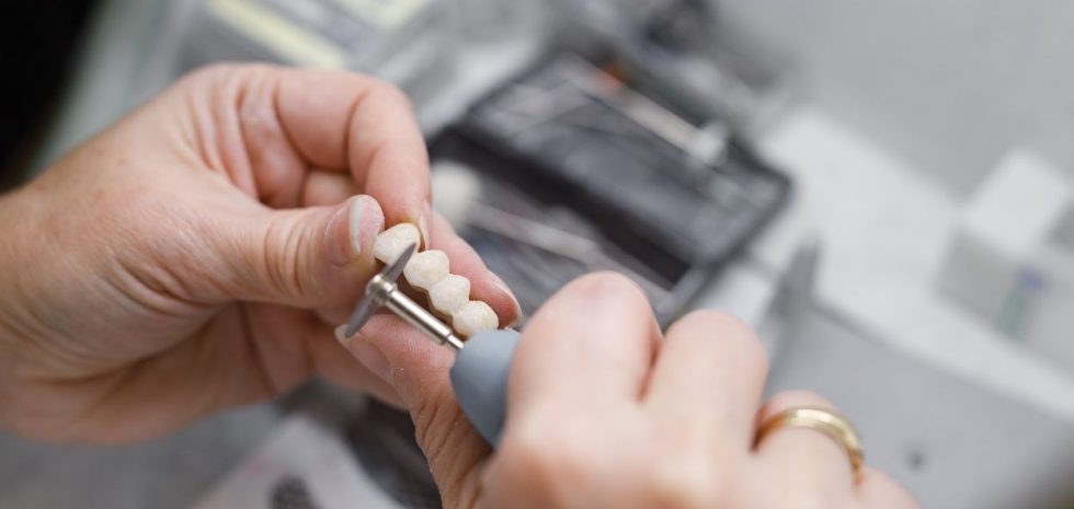Most protetyczny, a implant zębowy - co wybrać?
