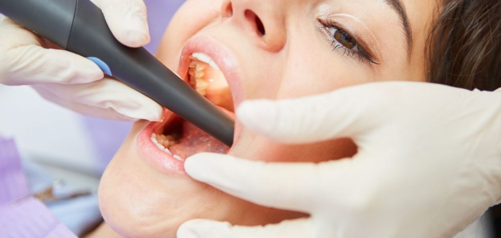 Wtórne leczenie kanałowe zęba